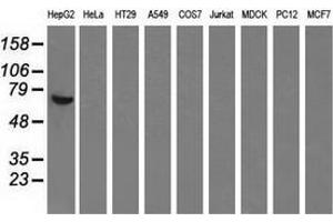Western blot analysis of extracts (35 µg) from 9 different cell lines by using anti-AFP monoclonal antibody. (alpha Fetoprotein anticorps)