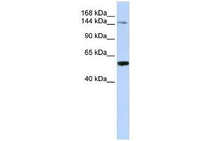 EDC4 antibody used at 1 ug/ml to detect target protein.