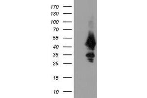 Image no. 2 for anti-Ubiquitin-Conjugating Enzyme E2, J1, U (UBE2J1) antibody (ABIN1501637)