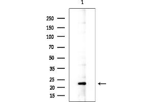 anti-Mitochondrial Ribosomal Protein L47 (MRPL47) (C-Term) antibody