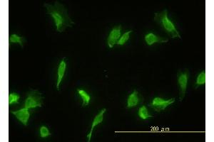 Immunofluorescence of monoclonal antibody to GLMN on HeLa cell.