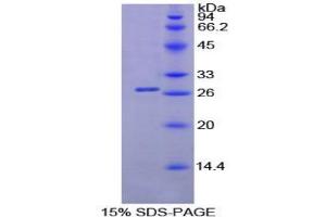 SDS-PAGE analysis of Mouse Lipase, Pancreatic Protein. (Lipase Protéine)