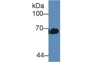 Detection of ALB in Mouse Serum using Polyclonal Antibody to Albumin (ALB) (Albumin anticorps)