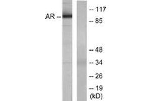 Western blot analysis of extracts from LOVO cells, using Androgen Receptor (Ab-650) Antibody. (Androgen Receptor anticorps  (AA 621-670))