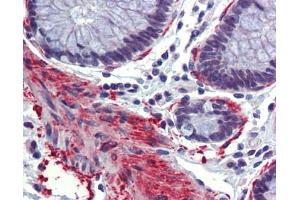 Rabbit Anti-CREBBP Antibody  arp43609 Paraffin Embedded Tissue: Human Colon Antibody Concentration: 5 ug/ml (CBP anticorps  (N-Term))