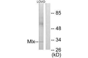 Western blot analysis of extracts from LOVO cells, using Mlx antibody. (MLX anticorps)