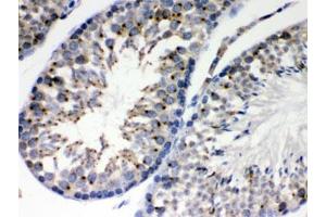 IHC testing of FFPE mouse testis with EBAG9 antibody. (RCAS1 anticorps  (AA 31-213))