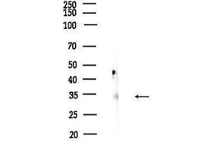 anti-ALX Homeobox 3 (ALX3) (Internal Region) antibody