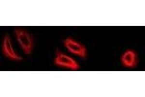 Immunofluorescent analysis of RNase 13 staining in MCF7 cells.