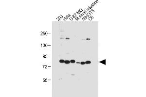 All lanes : Anti-cGKI (cGKI beta) Antibody (C-term) at 1:1000 dilution Lane 1: 293 whole cell lysate Lane 2: Hela whole cell lysate Lane 3: U-87 MG whole cell lysate Lane 4: Mouse small intestine tissue lysate Lane 5: NIH/3T3 whole cell lysate Lane 6: C6 whole cell lysate Lysates/proteins at 20 μg per lane.