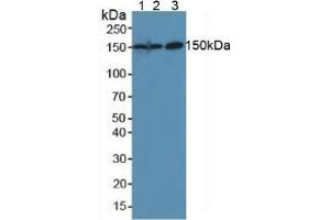 Figure. (CEA anticorps  (AA 544-771))