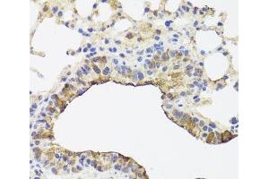Immunohistochemistry of paraffin-embedded Mouse lung using TOMM34 Polyclonal Antibody at dilution of 1:100 (40x lens). (TOMM34 anticorps)