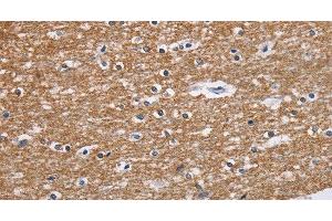 Immunohistochemistry of paraffin-embedded Human brain tissue using NCR2 Polyclonal Antibody at dilution 1:60 (NKp44/NCR2 anticorps)