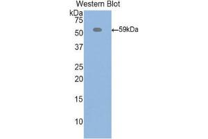 Western Blotting (WB) image for anti-Inter alpha Globulin Inhibitor H4 (ITIH4) (AA 478-722) antibody (ABIN1859513)