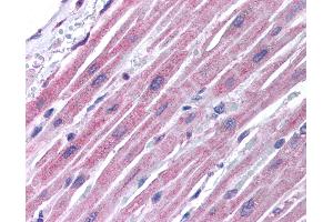 Anti-GJA5 / Connexin 40 antibody IHC of human heart.