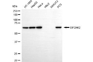 Western blotting analysis using EIF2AK2 antibody (ABIN7798508). (Recombinant EIF2AK2 anticorps)