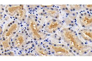 Detection of XIAP in Human Kidney Tissue using Polyclonal Antibody to X-linked Inhibitor Of Apoptosis Protein (XIAP)