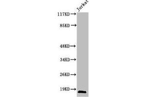 Western Blot analysis of Jurkat cells using Cleaved-Caspase-2 p18 (G170) Polyclonal Antibody (Caspase 2 anticorps  (Cleaved-Gly170))