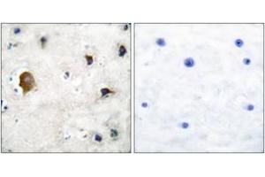 Immunohistochemistry analysis of paraffin-embedded human brain tissue, using Connexin 43 Antibody.