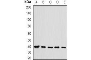 Western blot analysis of eIF3H expression in HL60 (A), HT29 (B), NIH3T3 (C), mouse testis (D), rat spleen (E) whole cell lysates. (EIF3H anticorps)