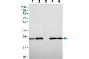 Western blot analysis of Lane 1: RT-4, Lane 2: U-251 MG, Lane 3: Human Plasma, Lane 4: Liver, Lane 5: Tonsil with C9orf142 polyclonal antibody  at 1:250-1:500 dilution. (C9orf142 anticorps)