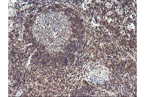Immunohistochemistry (IHC) image for anti-PDZ and LIM Domain 2 (PDLIM2) antibody (ABIN1500130)