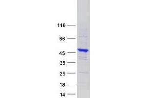 Validation with Western Blot