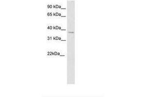 Image no. 1 for anti-Spleen Focus Forming Virus (SFFV) Proviral Integration Oncogene Spi1 (SPI1) (AA 61-110) antibody (ABIN202143)