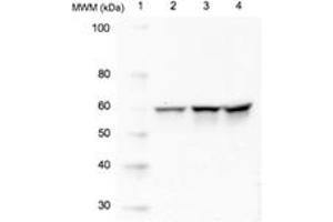 Western blot analysis of Src using 20 μg of whole cell lysate (Lane 2=HeLa, Lane 3=3T3, Lane 4=PC12) probed with with Src, mAb (5A18) at 1 μg/mL. (CSK anticorps)