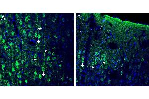 Expression of CX3CL1 in rat frontal cortex - Immunohistochemical staining of perfusion-fixed frozen rat brain sections with Anti-CX3CL1 (extracellular) Antibody (ABIN7043045, ABIN7044192 and ABIN7044193), (1:200), followed by goat anti-rabbit-AlexaFluor-488. (CX3CL1 anticorps  (Extracellular, N-Term))
