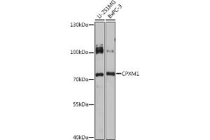 Western blot analysis of extracts of various cell lines, using CPXM1 antibody (ABIN7266082) at 1:1000 dilution. (CPXM1 anticorps)