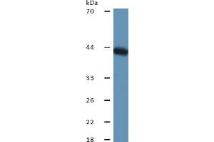 Rabbit Detection antibody from the kit in WB with Positive Control: Sample Mouse liver lysate.