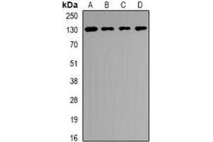 Western blot analysis of USP25 expression in SKOV3 (A), PC12 (B), mouse brain (C), mouse liver (D) whole cell lysates. (USP25 anticorps)