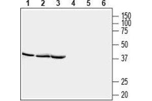 Western blot analysis of rat brain lysate (lanes 1 and 4), mouse brain lysate (lanes 2 and 5) and rat skeletal muscle lysate (lanes 3 and 6): - 1-3. (STOML2 anticorps  (Intracellular))