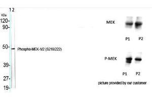 Western Blot (WB) analysis of specific cells using Phospho-MEK-1/2 (S218/222) Polyclonal Antibody. (MEK1/2 anticorps  (pSer218, pSer222))