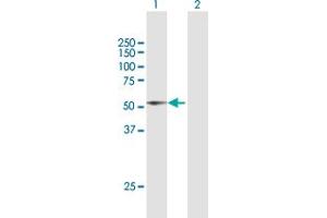 Western Blot analysis of DIAPH1 expression in transfected 293T cell line by DIAPH1 MaxPab polyclonal antibody.