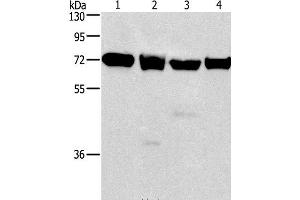 Western Blot analysis of 231, 293T, Raji and hela cell using IL2RB Polyclonal Antibody at dilution of 1:325 (IL2 Receptor beta anticorps)