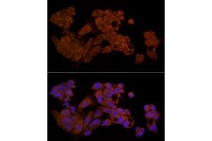 Immunofluorescence analysis of HepG2 cells using Caspase-8 Rabbit pAb (ABIN6131530, ABIN6137970, ABIN6137972 and ABIN6213676) at dilution of 1:200 (40x lens).