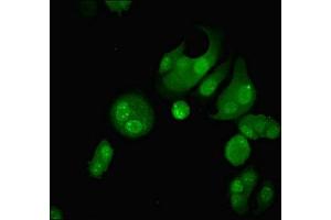 Immunofluorescent analysis of MCF-7 cells using ABIN7162002 at dilution of 1:100 and Alexa Fluor 488-congugated AffiniPure Goat Anti-Rabbit IgG(H+L)