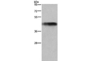 Western Blot analysis of Human fetal liver tissue using GALT Polyclonal Antibody at dilution of 1:300 (GALT anticorps)