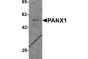 Western Blotting (WB) image for anti-Pannexin 1 (PANX1) (N-Term) antibody (ABIN1077400) (PANX1 anticorps  (N-Term))