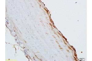Formalin-fixed and paraffin embedded rat aortic cavity labeled with Rabbit Anti-GM-CSF Polyclonal Antibody , Unconjugated 1:200 followed by conjugation to the secondary antibody and DAB staining (GM-CSF anticorps  (AA 71-141))