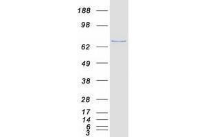 Validation with Western Blot