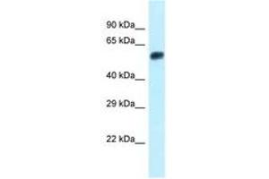 Image no. 1 for anti-Endonuclease/exonuclease/phosphatase Family Domain Containing 1 (EEPD1) (N-Term) antibody (ABIN6747925) (EEPD1 anticorps  (N-Term))