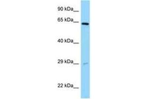 Image no. 1 for anti-Sorting Nexin 11 (SNX11) (AA 90-139) antibody (ABIN6748157) (SNX11 anticorps  (AA 90-139))