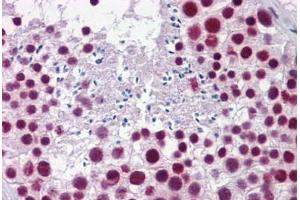 Human Testis: Formalin-Fixed, Paraffin-Embedded (FFPE)