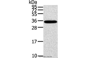 Western blot analysis of Mouse brain tissue, using KCNMB3 Polyclonal Antibody at dilution of 1:300 (KCNMB3 anticorps)