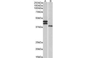 Western Blotting (WB) image for anti-Fc Receptor-Like 1 (FCRL1) (AA 165-177) antibody (ABIN5900722)