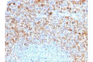 Formalin-fixed, paraffin-embedded human Spleen stained with CD40L-Monospecific Mouse Monoclonal Antibody (CD40LG/2761) (CD40 Ligand anticorps  (AA 108-261))
