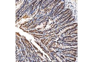 IHC analysis of SNRPA1 using anti-SNRPA1 antibody (ABIN7599131).